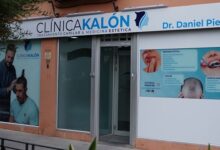 Ya no tienes que irte fuera de Alcalá para recuperar tu pelo.